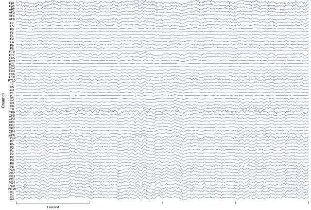 EEG reading from 64 electrodes