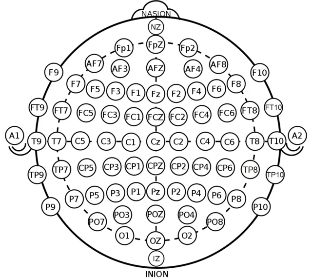 The usual placement of electrodes