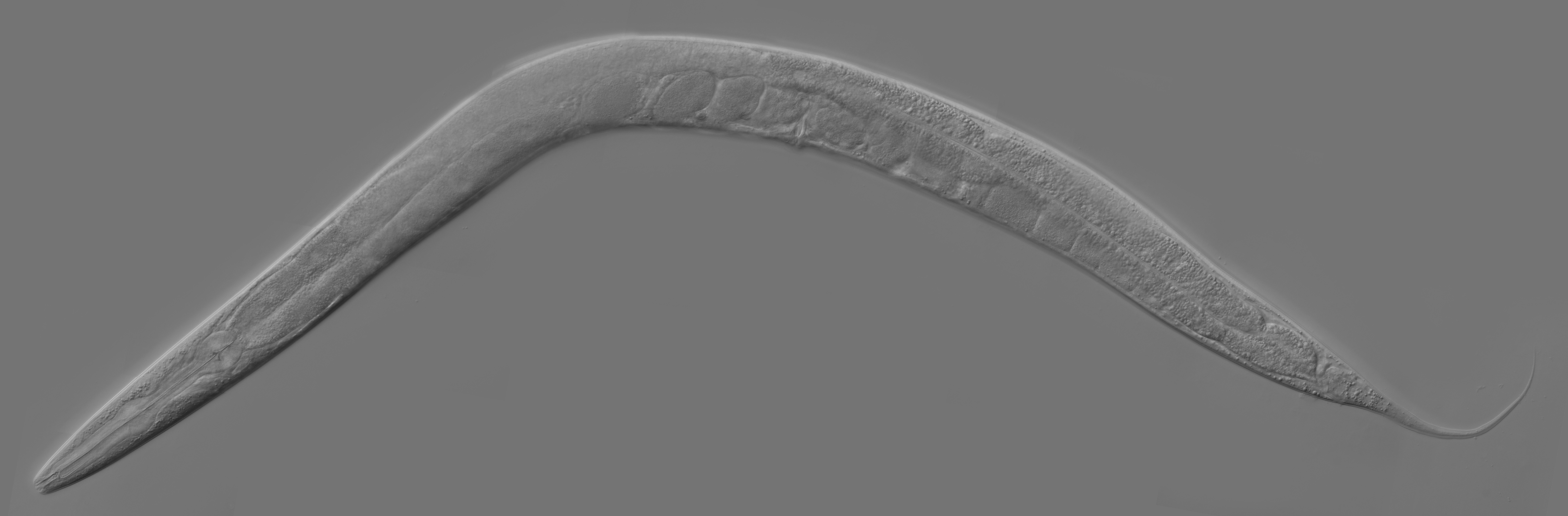 C. elegans work seen under the microscope